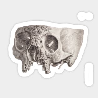 Diseased Skull, Unknown Sticker